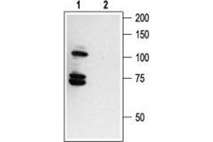 Western blot analysis of human melanoma cells A875:1. (Nerve Growth Factor Receptor (NGFR) Peptid)