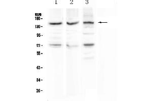 Western blot analysis of CD163 using anti-CD163 antibody .