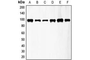 Western blot analysis of FGFR3 expression in HeLa (A), A549 (B), T47D (C), mouse kidney (D), mouse heart (E), rat lung (F) whole cell lysates. (FGFR3 Antikörper  (Center))