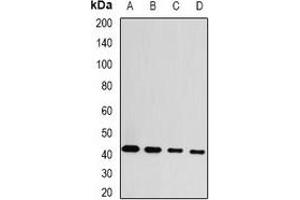Western blot analysis of GDAP1 expression in MCF7 (A), HepG2 (B), mouse brain (C), rat brain (D) whole cell lysates. (GDAP1 Antikörper)