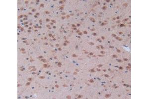 Used in DAB staining on fromalin fixed paraffin- embedded brain tissue (CD28 Antikörper  (AA 33-174))