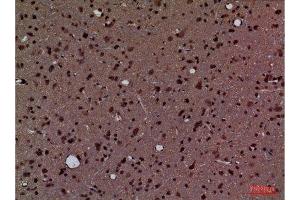 Immunohistochemistry (IHC) analysis of paraffin-embedded Rat Brain, antibody was diluted at 1:100.