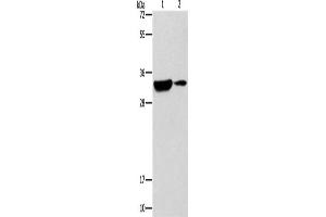 Western Blotting (WB) image for anti-Regulator of Calcineurin 1 (RCAN1) antibody (ABIN2432541)