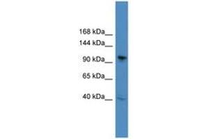 Image no. 1 for anti-B-Cell CLL/lymphoma 11B (Zinc Finger Protein) (BCL11B) (C-Term) antibody (ABIN6745310) (BCL11B Antikörper  (C-Term))