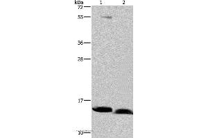 Western blot analysis of Human bladder carcinoma and fetal brain tissue, using NDUFA5 Polyclonal Antibody at dilution of 1:400 (NDUFA5 Antikörper)