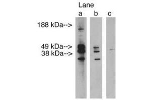 Image no. 1 for anti-Ceramide Synthase 3 (CERS3) antibody (ABIN793688) (LASS3 Antikörper)