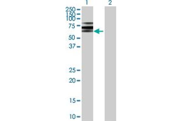 ATP6V1B2 Antikörper  (AA 1-511)