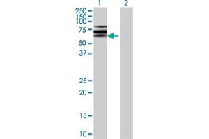 Western Blot analysis of ATP6V1B2 expression in transfected 293T cell line by ATP6V1B2 MaxPab polyclonal antibody. (ATP6V1B2 Antikörper  (AA 1-511))