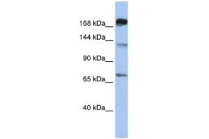 MTR antibody used at 1 ug/ml to detect target protein. (MTR Antikörper  (C-Term))