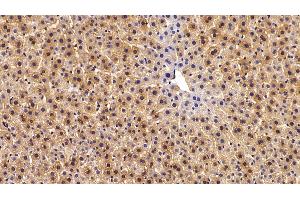 Immunohistochemistry (IHC) image for anti-Argininosuccinate Synthase 1 (ASS1) (AA 1-412) antibody (ABIN7434815)