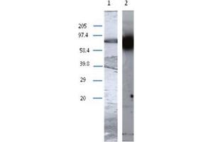 Western Blot analysis using TGM1 antibody Cat. (TGM1 Antikörper)