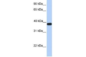 ASB5 antibody used at 1 ug/ml to detect target protein.