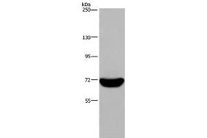 Western Blot analysis of Raji cell using LCP1 Polyclonal Antibody at dilution of 1:300 (LCP1 Antikörper)