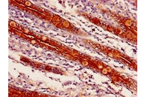 Immunohistochemistry of paraffin-embedded human small intestine tissue using ABIN7143250 at dilution of 1:100 (APEH Antikörper  (AA 201-500))