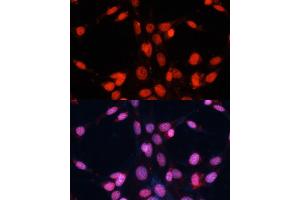 Immunofluorescence analysis of NIH/3T3 cells using FUS antibody (ABIN6127938, ABIN6140818, ABIN6140819 and ABIN7101788) at dilution of 1:100. (FUS Antikörper  (AA 297-526))