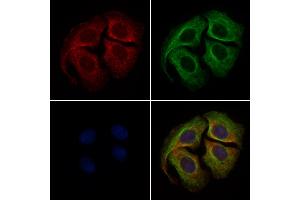 ABIN6261484 and ABIN6279421 staining Hela cells by IF/ICC. (EIF3S1 Antikörper  (Internal Region))