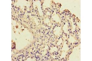Immunohistochemistry of paraffin-embedded human lung tissue using ABIN7175770 at dilution of 1:100