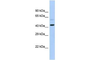 Host:  Rabbit  Target Name:  SLC16A7  Sample Type:  Fetal Heart lysates  Antibody Dilution:  1.