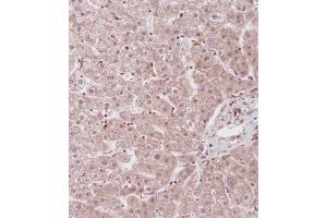 Immunohistochemical analysis of (ABIN655663 and ABIN2845135) on paraffin-embedded Human liver tissue. (ID1 Antikörper  (AA 66-93))
