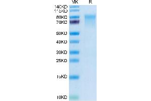 Mouse IL-15RA on Tris-Bis PAGE under reduced condition. (IL15RA Protein (AA 33-205) (Fc Tag))