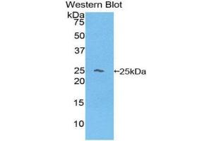 Western Blotting (WB) image for anti-Hemoglobin beta (HBB) (AA 1-145) antibody (ABIN5662058)