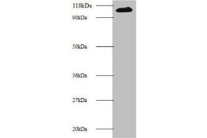 Western blot All lanes: MIB1 antibody at 2 μg/mL + 293T whole cell lysate Secondary Goat polyclonal to rabbit IgG at 1/10000 dilution Predicted band size: 111 kDa Observed band size: 111 kDa