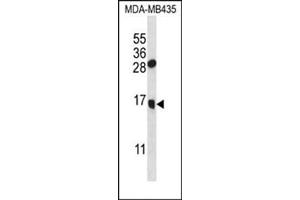 Western blot analysis in MDA-MB435 cell line lysates (35 ug/lane) using GNLY Antibody (C-term) Cat. (GNLY Antikörper  (N-Term))