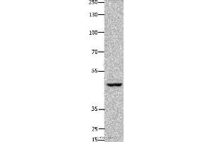 Western blot analysis of Hela cell, using FOXD3 Polyclonal Antibody at dilution of 1:450 (FOXD3 Antikörper)