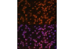 Immunofluorescence analysis of C6 cells using FUBP1 antibody (ABIN6130392, ABIN6140802, ABIN6140804 and ABIN6221231) at dilution of 1:100. (FUBP1 Antikörper  (AA 302-644))