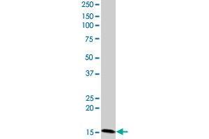 CIDEC monoclonal antibody (M07), clone 2E2. (CIDEC Antikörper  (AA 53-141))