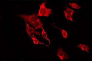 ABIN6277679 staining HT29 by IF/ICC. (Serotonin Receptor 3A Antikörper  (Internal Region))