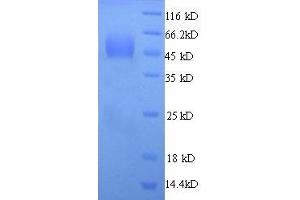 SDS-PAGE (SDS) image for Syndecan 1 (SDC1) (AA 23-257) protein (His tag) (ABIN7479032)