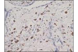 Immunohistochemistry (IHC) image for anti-CD163 (CD163) (N-Term) antibody (ABIN870407) (CD163 Antikörper  (N-Term))
