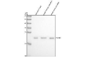 Western blot analysis of DJ-1/PARK7 using anti-DJ-1/PARK7 antibody (AZQ5XJ36).
