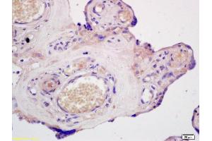 Formalin-fixed and paraffin embedded human placenta labeled with Anti-ABCG1 Polyclonal Antibody, Unconjugated (ABIN673719) at 1:200 followed by conjugation to the secondary antibody and DAB staining. (ABCG1 Antikörper  (AA 561-678))