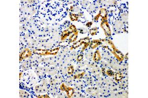Anti-NADPH oxidase 4 antibody, IHC(P) IHC(P): Rat Kidney Tissue (NADPH Oxidase 4 Antikörper  (C-Term))