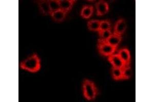 Immunofluorescent analysis of GBL staining in MCF7 cells. (GBL Antikörper)