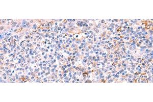 Immunohistochemistry of paraffin-embedded Human tonsil tissue using FUCA2 Polyclonal Antibody at dilution of 1:70(x200)