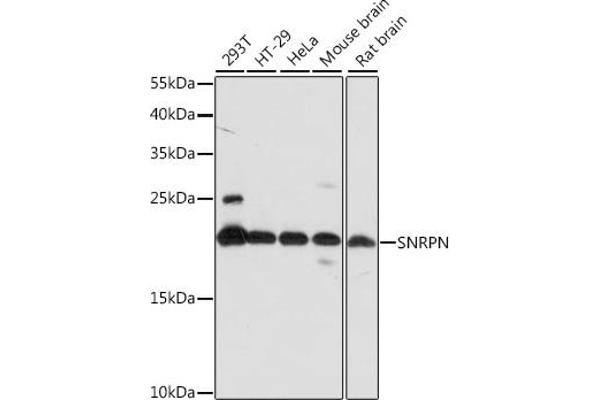 SNRPN Antikörper  (AA 1-100)