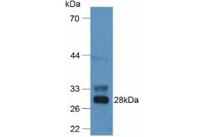 Figure. (F12 Antikörper  (AA 352-587))