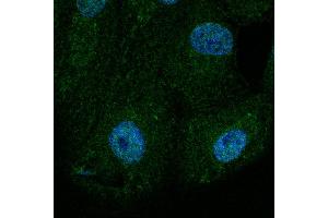 Immunofluorescence - anti-BAX Ab at 1/100 dilution in NHl/3T3 cells, cells were fixed with methanol and permeabilized With 0.