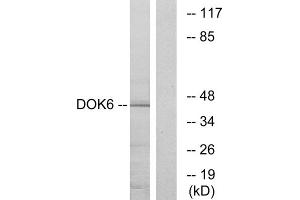 Western blot analysis of extracts from COLO cells, using DOK6 antibody. (DOK6 Antikörper  (Internal Region))