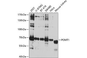 Western blot analysis of extracts of various cell lines, using POMT1 antibody (ABIN6132825, ABIN6145953, ABIN6145954 and ABIN6214473) at 1:1000 dilution. (POMT1 Antikörper  (AA 310-550))