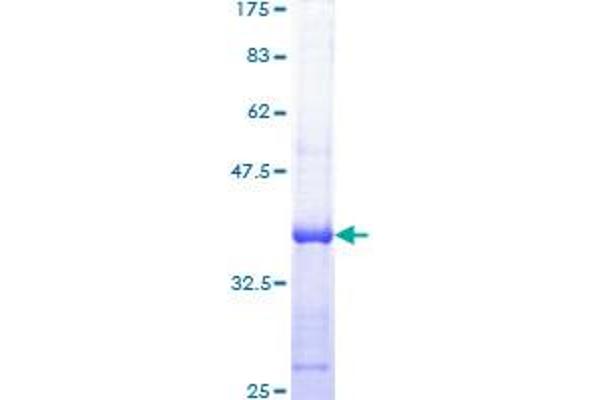 RPA1 Protein (AA 1-110) (GST tag)