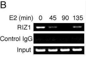 Image no. 1 for anti-PR Domain Containing 2, with ZNF Domain (PRDM2) antibody (ABIN2995299) (PRDM2 Antikörper)