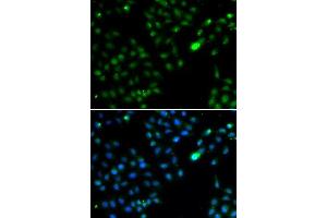 Immunofluorescence analysis of HeLa cells using FKBP3 antibody. (FKBP3 Antikörper  (AA 1-224))