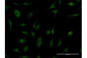 Immunofluorescence of purified MaxPab antibody to TBC1D1 on HeLa cell. (TBC1D1 Antikörper  (AA 1-1168))