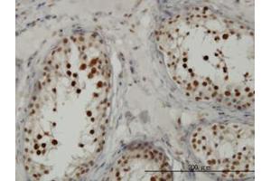 Image no. 5 for anti-Transcription Factor 19 (TCF19) (AA 17-103) antibody (ABIN598965) (TCF19 Antikörper  (AA 17-103))