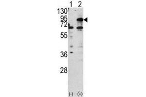 Western blot analysis of CPT1B antibody and 293 cell lysate either nontransfected (Lane 1) or transiently transfected with the CPT1B gene (2). (CPT1B Antikörper  (AA 606-637))