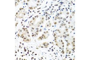 Immunohistochemistry of paraffin-embedded human stomach using IGF2BP1 antibody at dilution of 1:100 (40x lens).